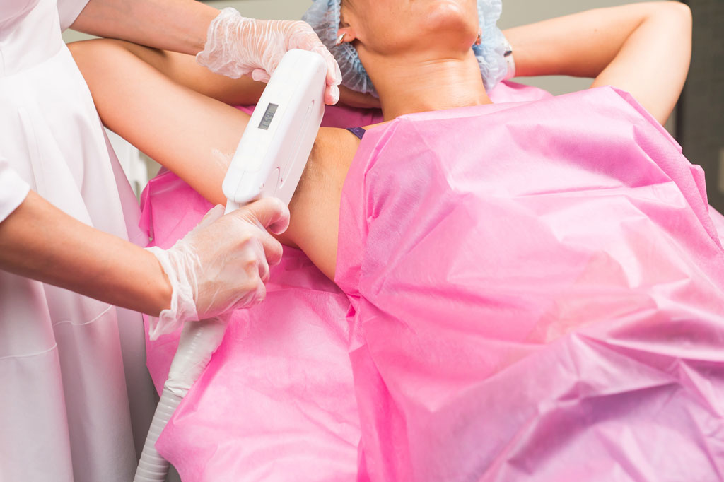 laser αποτρίχωση στη Χαλκίδα με παλμικό φως IPL