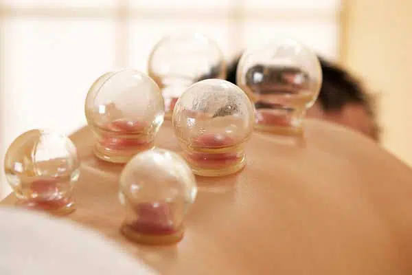 Cupping Therapy Χαλκίδα